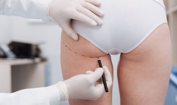 o que é a cirurgia plástica combinada